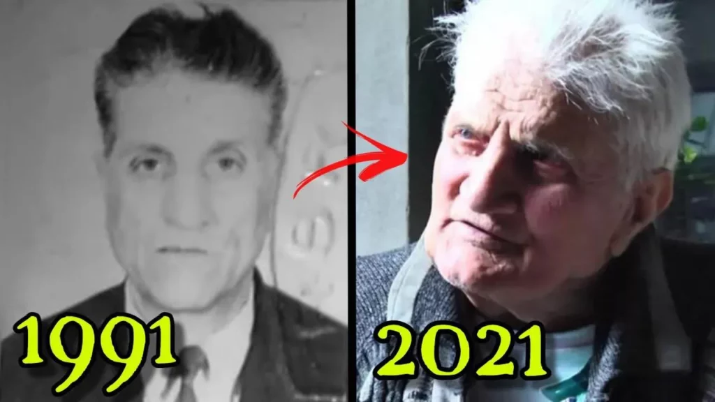 Vasile Gorgos Before and After photo